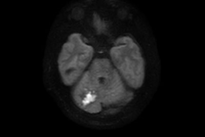 MRI simulation with DWI TSE and FLAIR