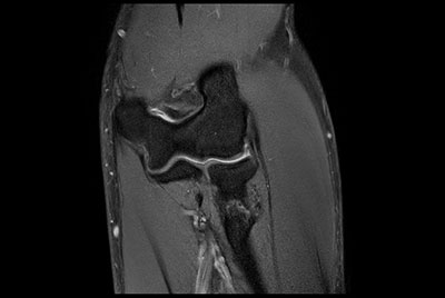 Fat-free elbow imaging
