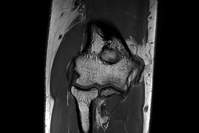 Imaging with the dS 16ch Small Extremity coil