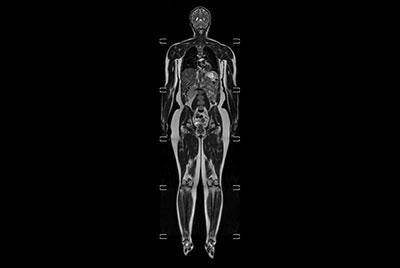 Whole Body imaging under 30 minutes on BlueSeal magnet