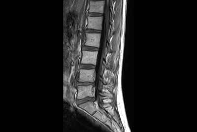 Lumbar Spine in under 10 minutes total exam time