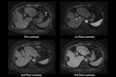 Advanced Liver imaging