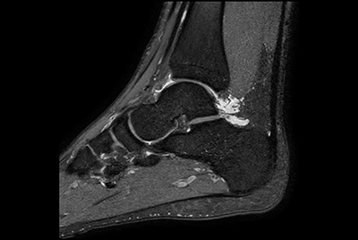 High resolution Ankle imaging in short scan times