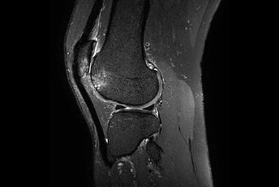 High quality Knee imaging in short scan times