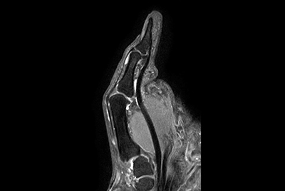 Thumb imaging