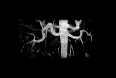 Contrast-free renal imaging