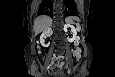 Multi-phase, contrast-enhanced renal imaging