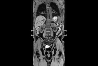 Abdomen large FOV imaging