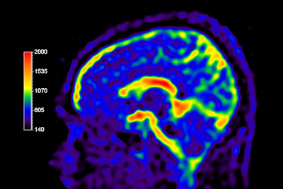 Multi Nuclei - Brain imaging (23Na)