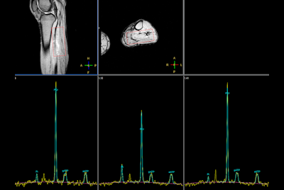 Multi Nuclei - Dynamic calf muscle imaging (31P)
