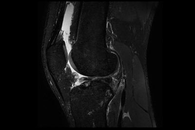 SmartSpeed Traumatic Knee imaging