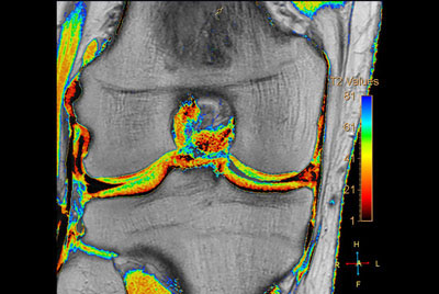 Comprehensive 3D knee imaging with MSK VIEW