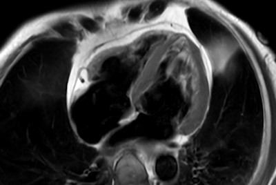 Comprehensive Cardiac with SmartSpeed Precise