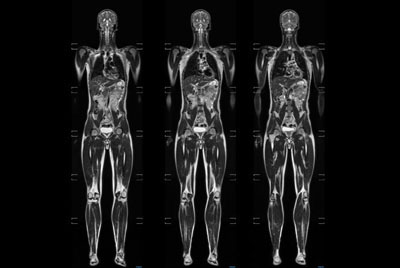 Total Body Imaging