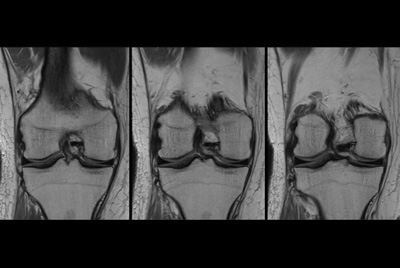 Knee imaging