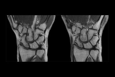 Wrist imaging