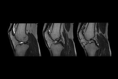 3D Knee imaging with MSK VIEW