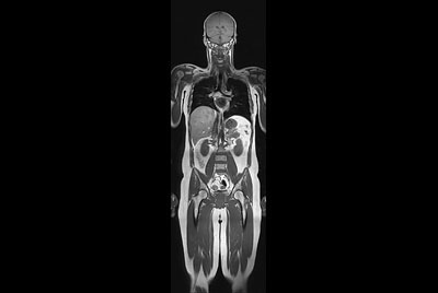 Whole Body imaging