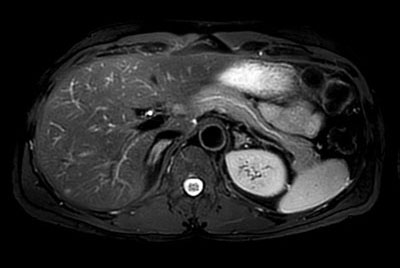 Comprehensive Liver imaging at 3.0T