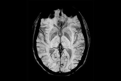 Comprehensive Brain imaging at 3.0T