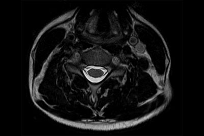 Comprehensive Cervical Spine imaging at 1.5T