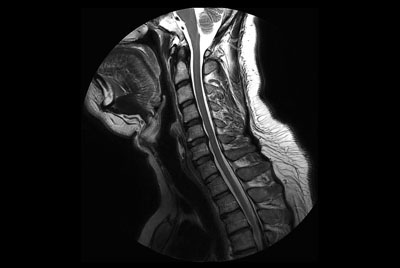 Comprehensive Cervical Spine imaging at 3.0T