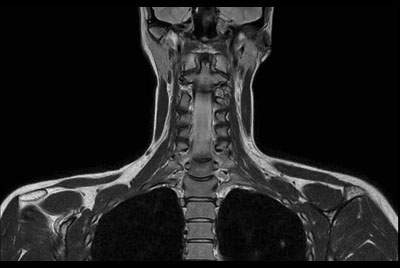 Posterior Triangle