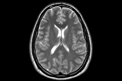 Brain imaging using ComforTone