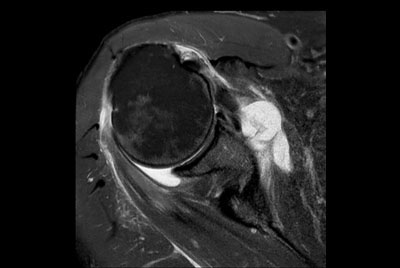 Shoulder imaging using ComforTone