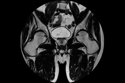 Prostate imaging