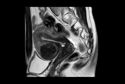 Female Pelvis