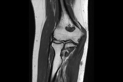 Elbow Imaging