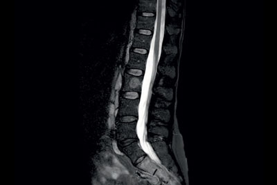 Comprehensive Lumbar Spine imaging at 1.5T